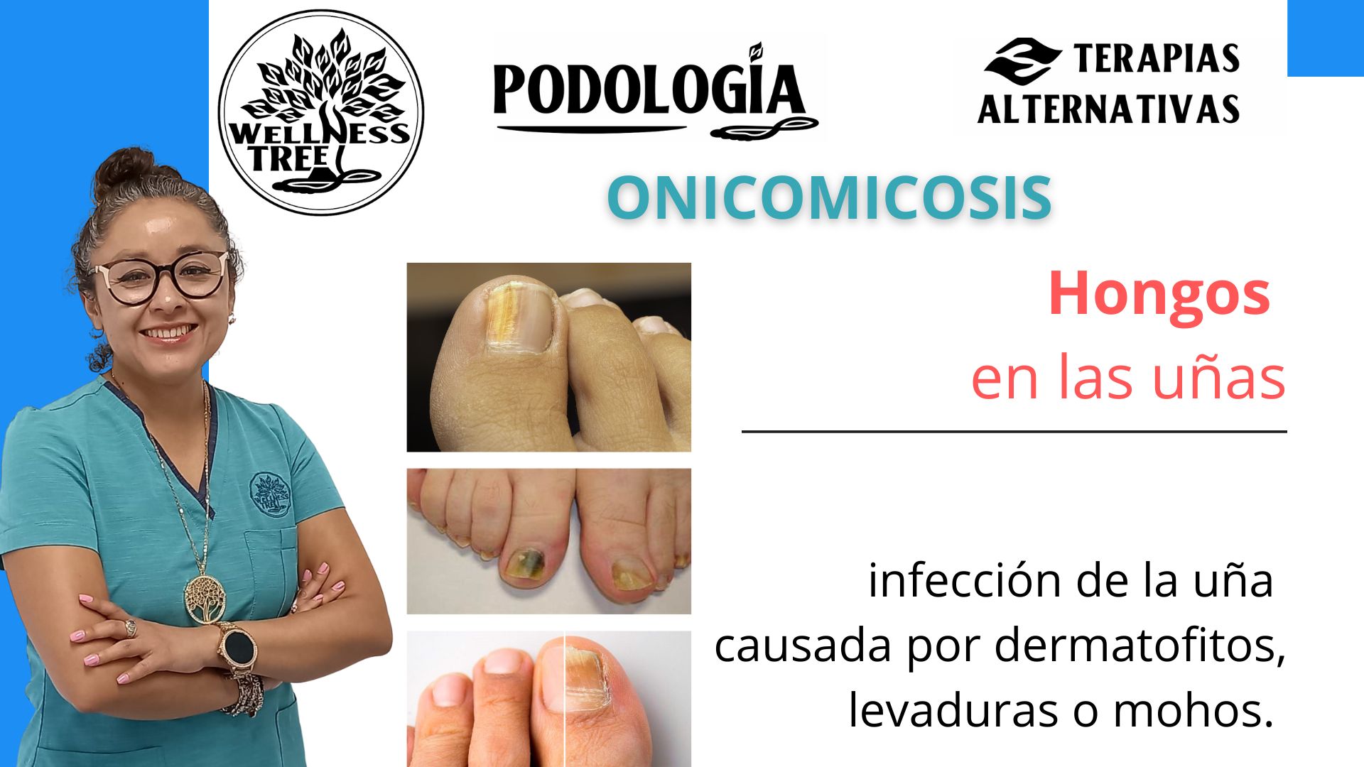LA IMPORTANCIA DEL CUIDADO DE TUS PIES 